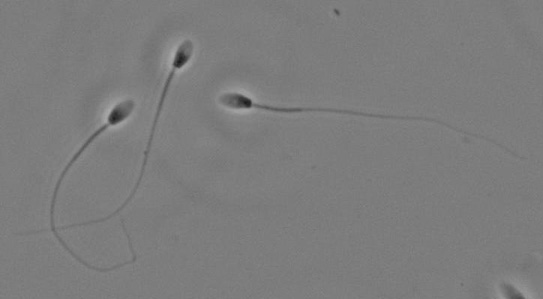 Stallion Seme Sperm