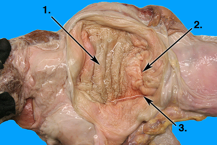 anterior vagina
