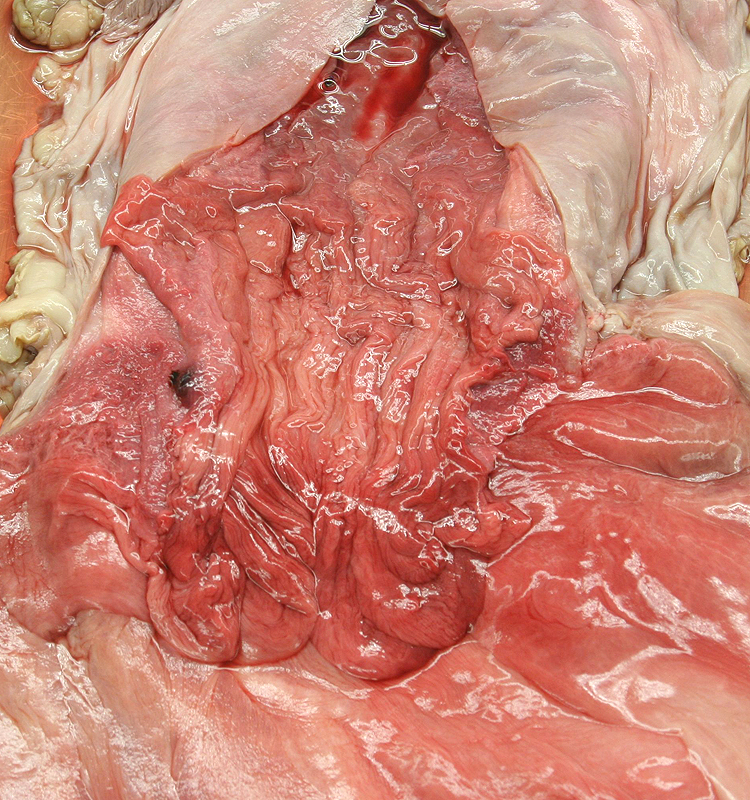 Cervix