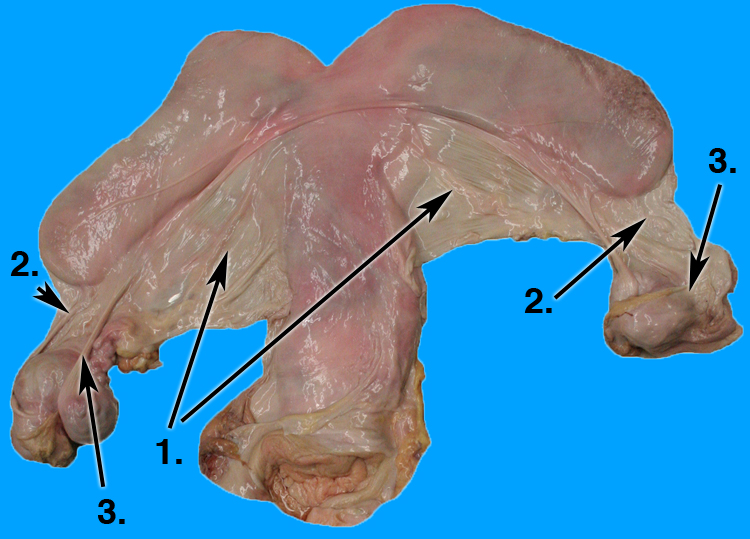 broad ligament