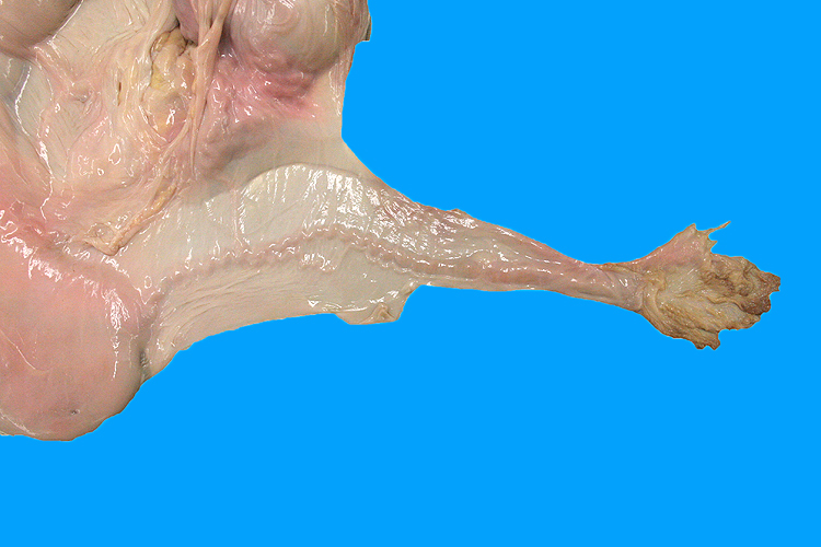 oviduct