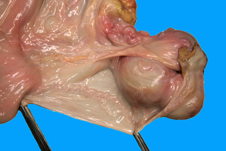 oviduct