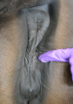 vulva 80% below pelvis