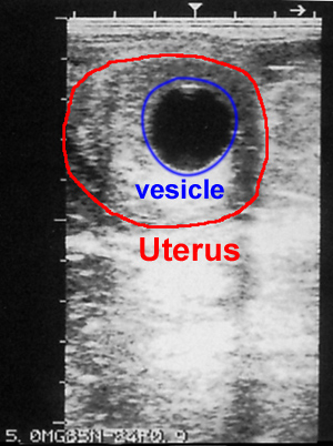 ultrasound image of 16 day fetal vesicle