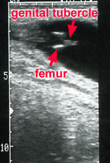 ultrasound image of 62 day female fetus