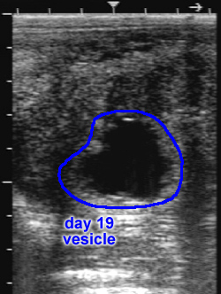 ultrasound image of day 19 vesicle