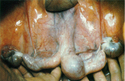day 30 pregnant tract