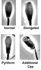 pictures of head abnormalities of stallion sperm